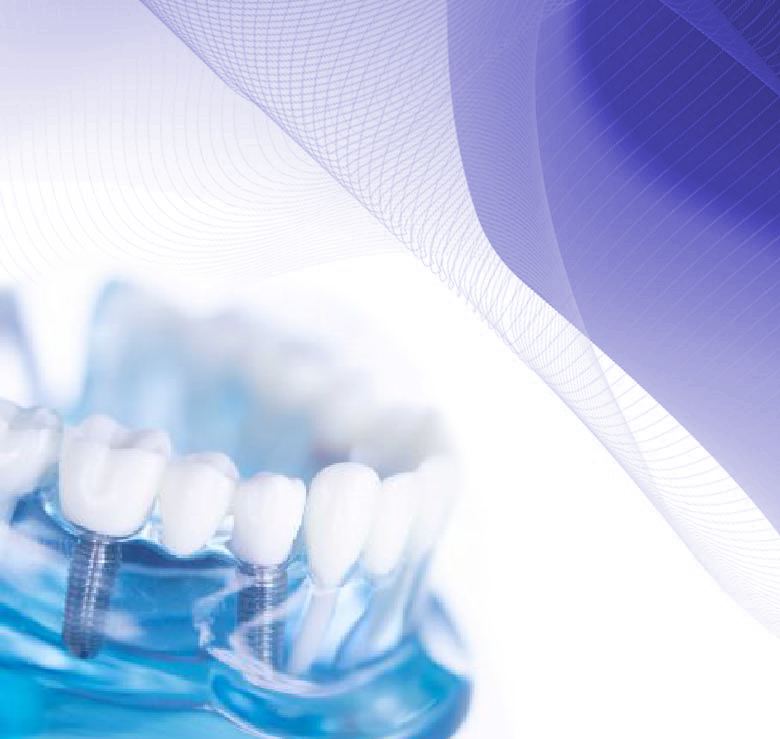 ایمپلنت دندان در کرج , ایمپلنت دندان , ایمپلنت در کرج , متخصص ایمپلنت در کرج , کاشت دندان در کرج